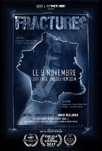 Fractures