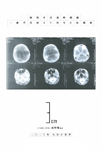 3cm