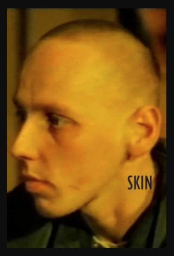 Скинхэд
