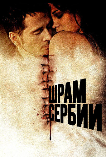 Шрам Сербии