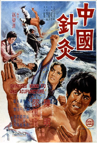 中國針灸