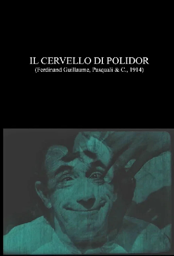 Il cervello di Polidor