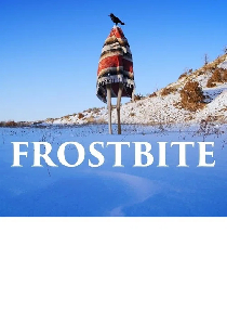 Frostbite