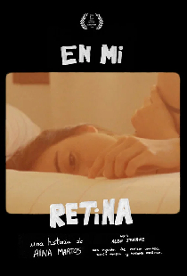 En mi retina