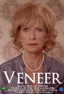 Veneer