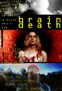 Brain Death