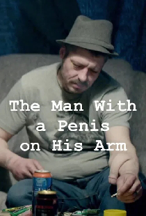The Man With a Penis on His Arm