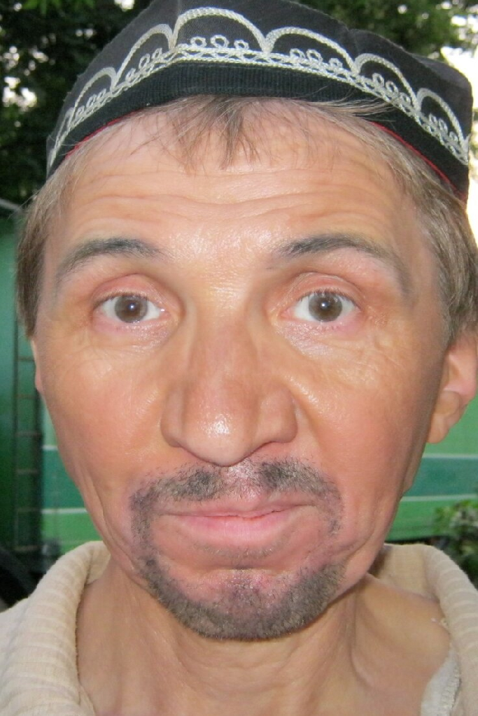 Ильдар Аллабирдин
