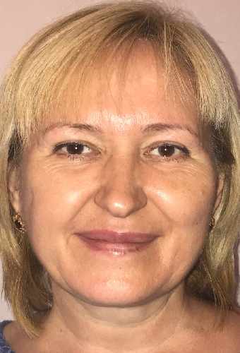 Галина Игнатьева